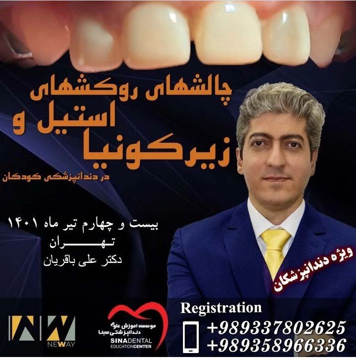 پوستر دوره چالش های روکش استیل و زیرکونیا